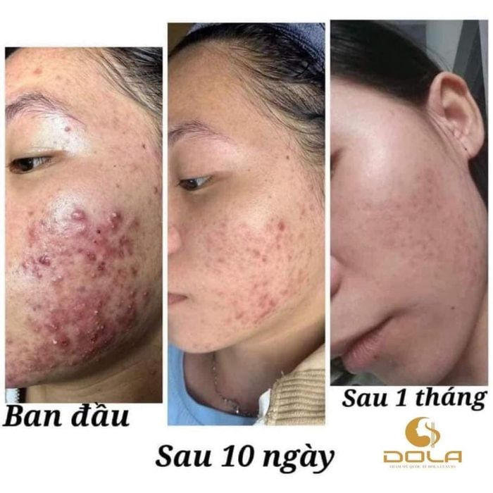 Ảnh 2 của DOLA Xinh Spa