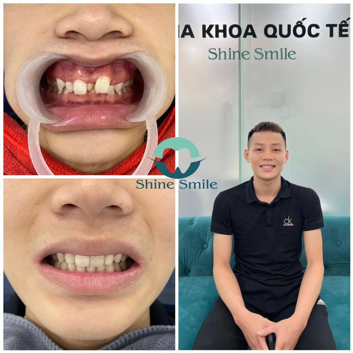 Hình ảnh của Nha Khoa Quốc Tế Shine Smile