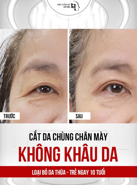 Hình ảnh Viện Thẩm Mỹ Hà Nội 3
