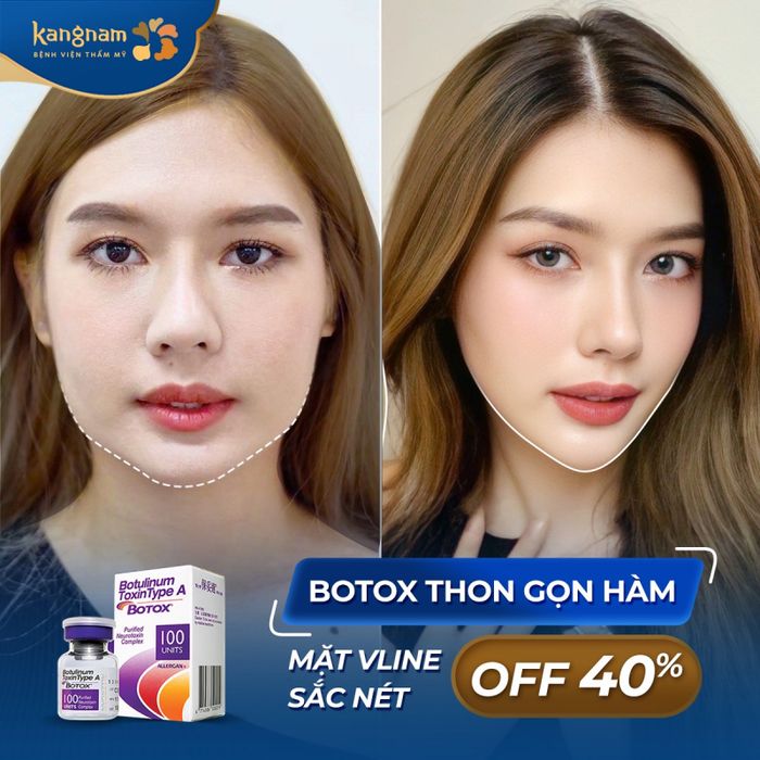Hình ảnh Bệnh viện thẩm mỹ Kangnam 1