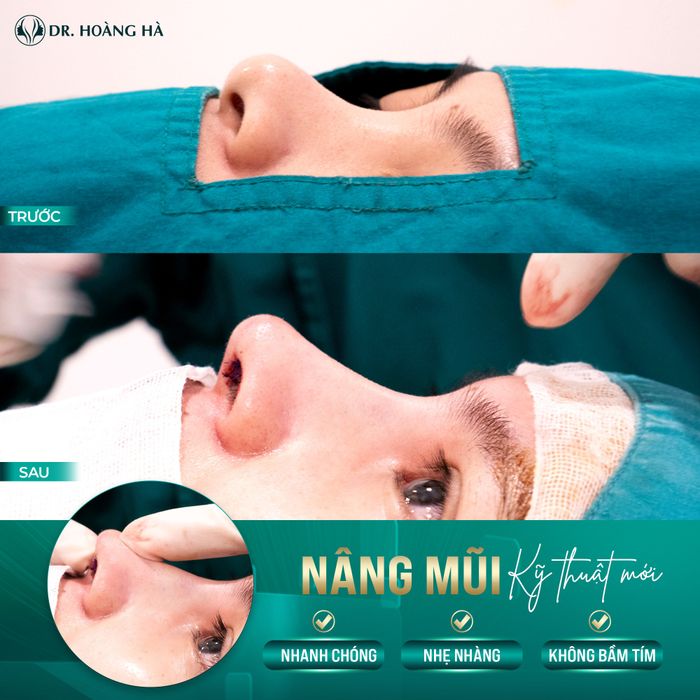 Hình ảnh Thẩm mỹ viện Dr. Hoàng Hà 3