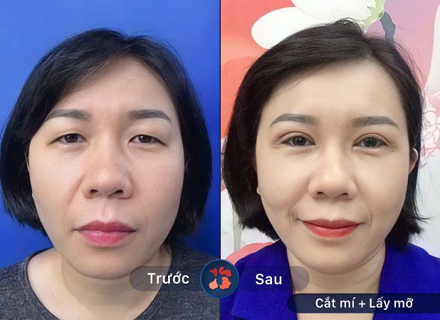 Hình ảnh Bệnh viện thẩm mỹ Kangnam 3
