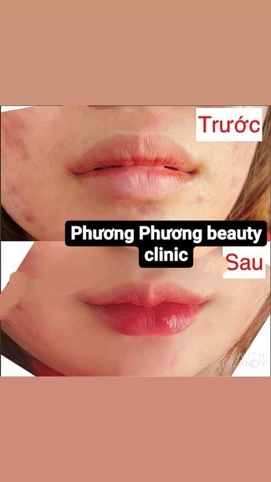 Hình ảnh Phương Phương Beauty Clinic 1