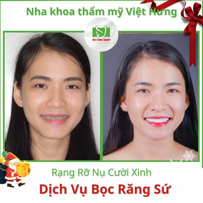 Hình ảnh của Nha Khoa Thẩm Mỹ Việt Hưng