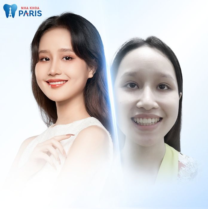 Hình ảnh Nha khoa Paris