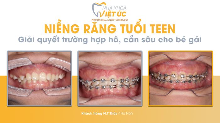 Hình ảnh NHA KHOA VIỆT ÚC 2