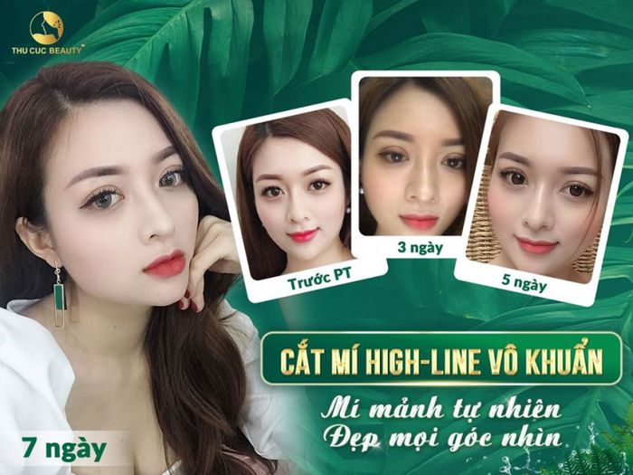 Hình ảnh Thẩm Mỹ Thu Cúc 1