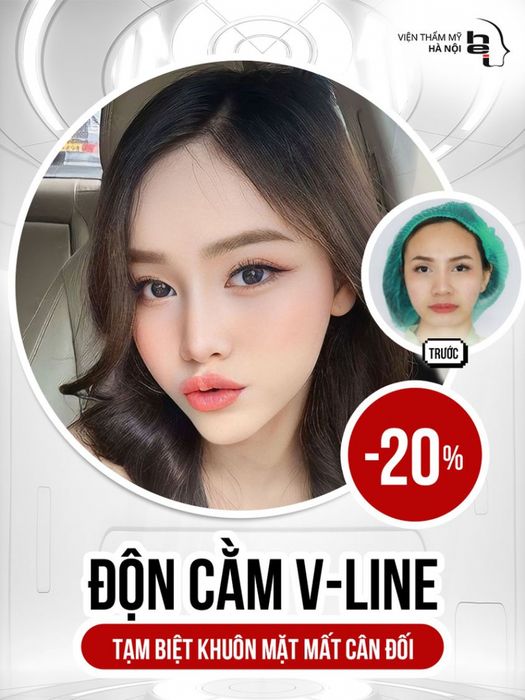 Hình ảnh Viện Thẩm Mỹ Hà Nội 1