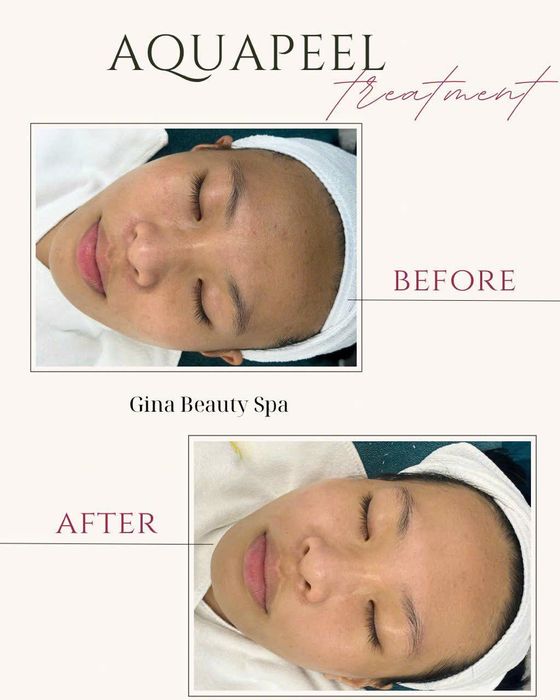 Hình ảnh 1 của Gina Beauty Spa tại quận Cầu Giấy, Hà Nội