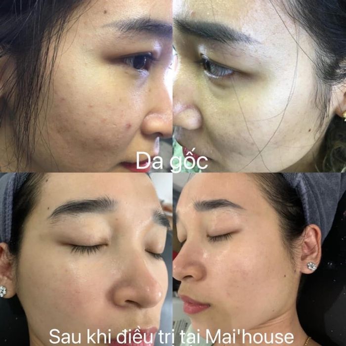 Hình ảnh Mai'House Natural 1