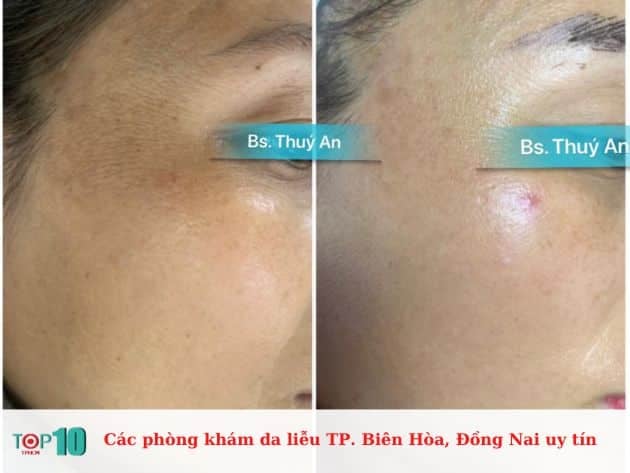 Các cơ sở chăm sóc da liễu đáng tin cậy tại TP. Biên Hòa, Đồng Nai