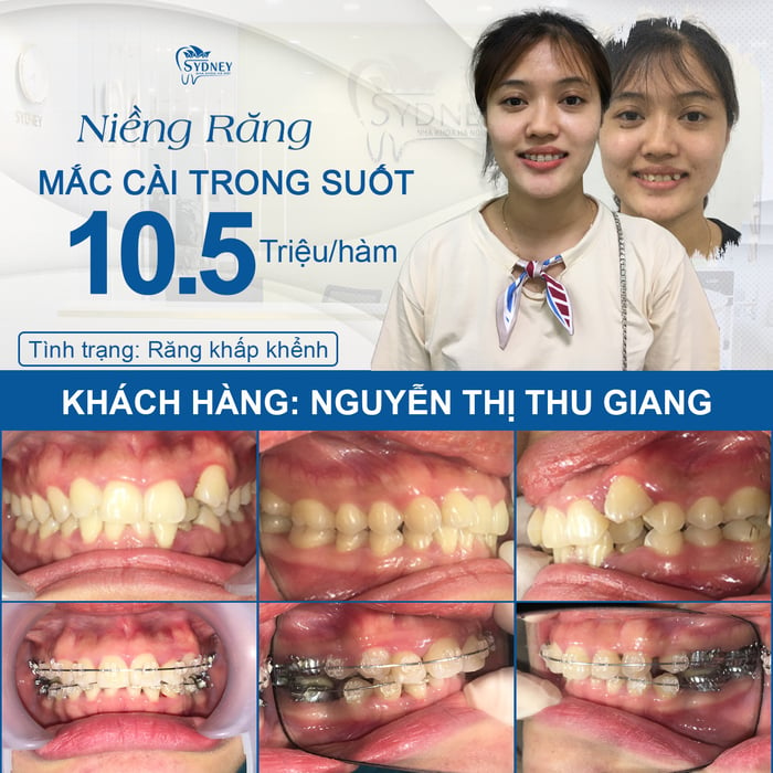 Hình ảnh Trung Tâm Nha khoa Hanoi Sydney 2