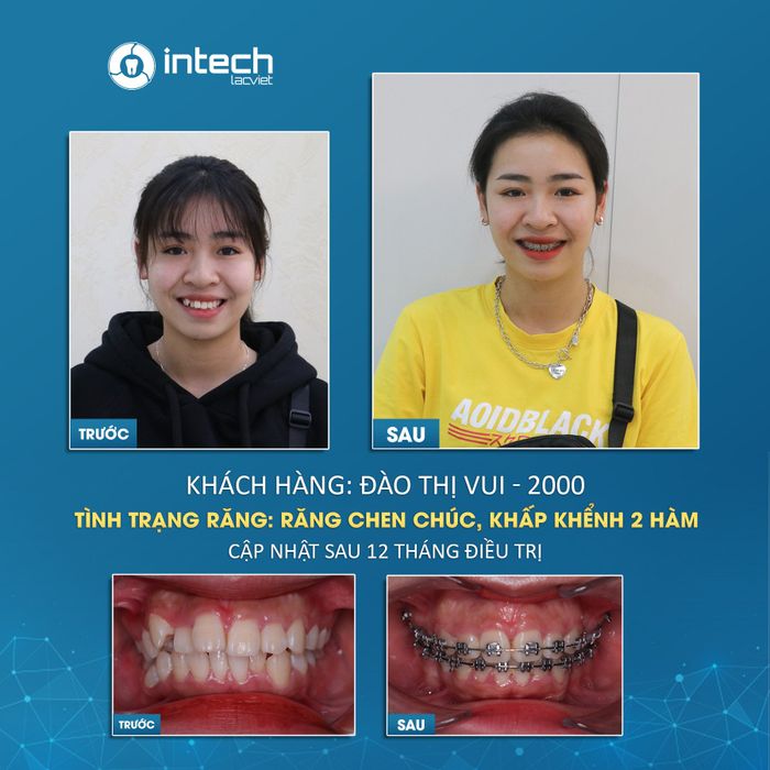 Nha Khoa Lạc Việt Intech hình 1