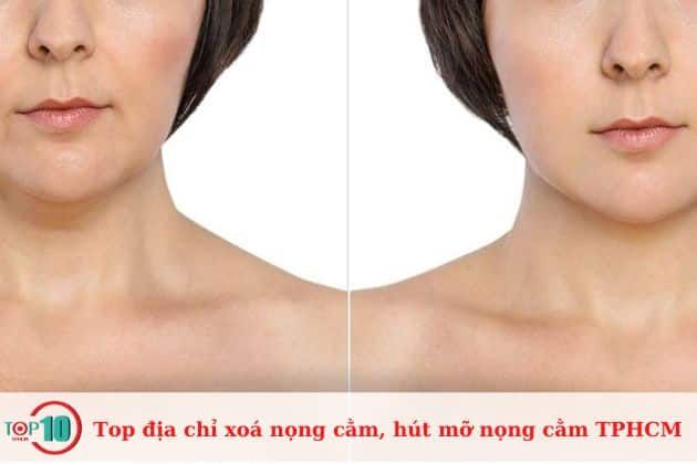 Thẩm Mỹ Viện Á Đông