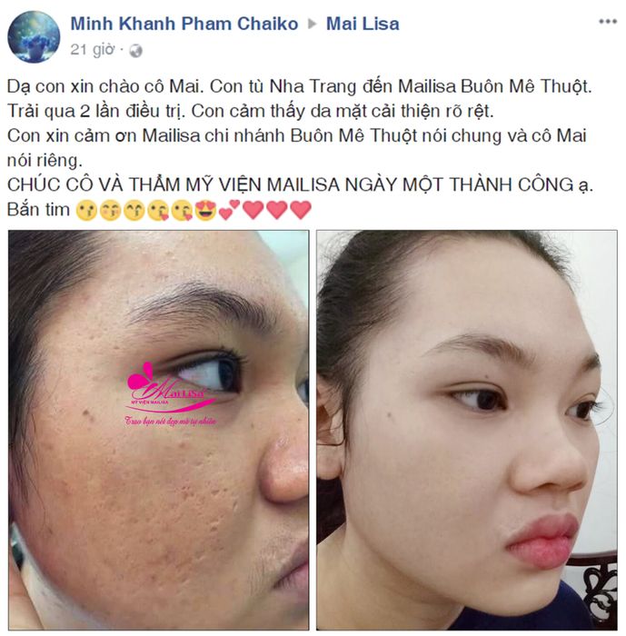 Hình ảnh Thẩm Mỹ Viện Mailisa 2