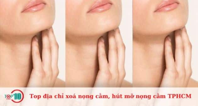 Các địa chỉ hàng đầu để xóa nọng cằm và hút mỡ nọng cằm chất lượng ở TPHCM