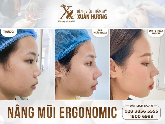 Hình ảnh Thẩm mỹ viện Xuân Hương 2