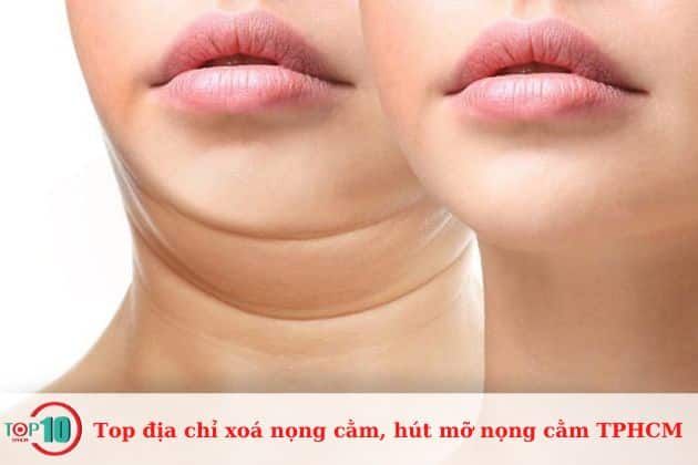 Bệnh viện JW Hàn Quốc