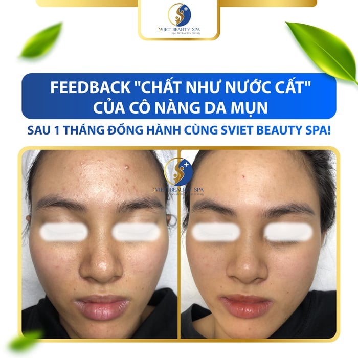 Ảnh 2 tại Sviet Beauty Spa