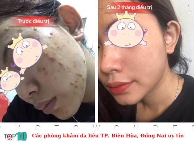 Danh sách các phòng khám da liễu uy tín tại TP. Biên Hòa, Đồng Nai