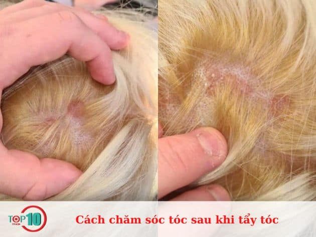 Hướng dẫn chăm sóc tóc sau khi tẩy