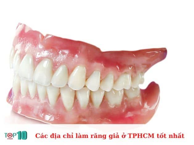 Những địa chỉ làm răng giả hàng đầu tại TPHCM