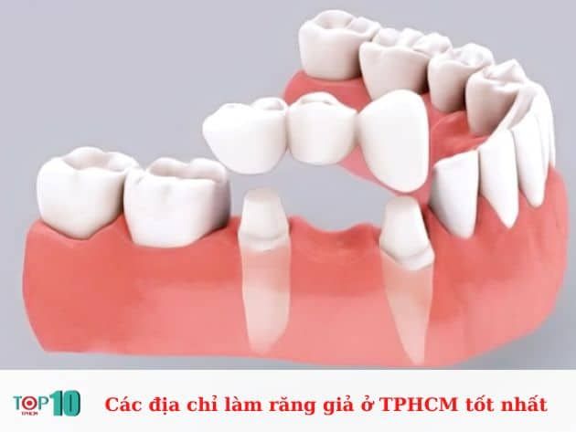 Nơi làm răng giả tốt nhất