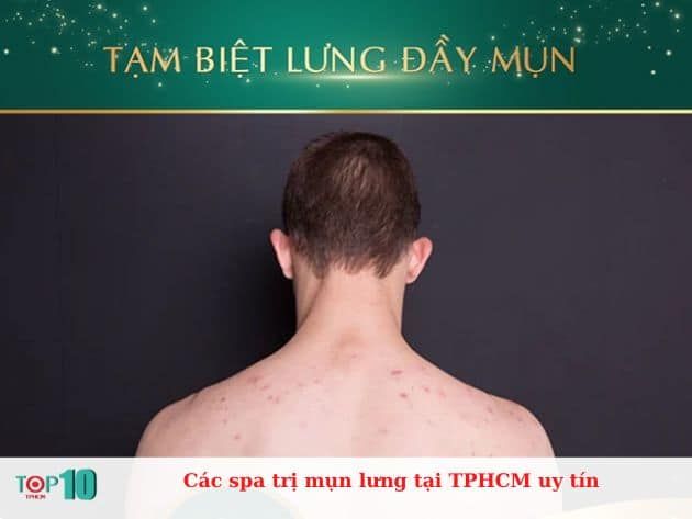 Những spa trị mụn lưng uy tín tại TPHCM