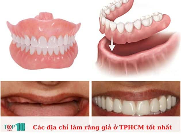 Danh sách các địa chỉ làm răng giả hàng đầu tại TPHCM