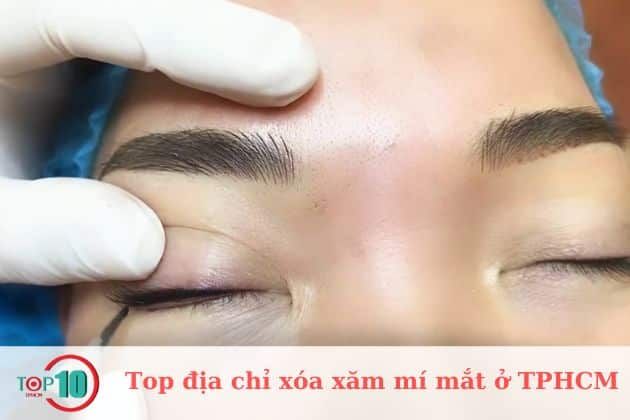 Các cơ sở xóa xăm mí mắt nổi bật ở TPHCM