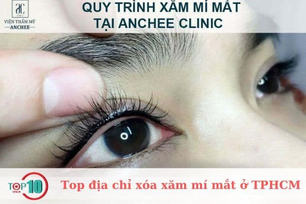 Viện thẩm mỹ Anchee Clinic