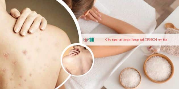 Những spa hàng đầu tại TPHCM chuyên trị mụn lưng