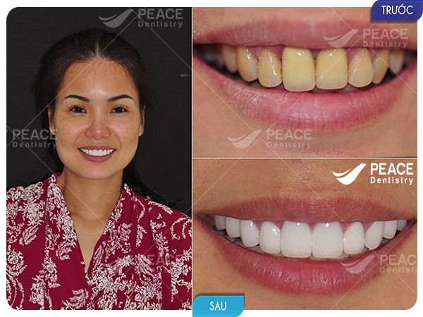 Nha khoa Peace Dentistry - Địa chỉ uy tín tại Quận 1