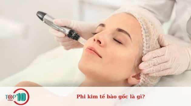 Phi kim tế bào gốc là gì?