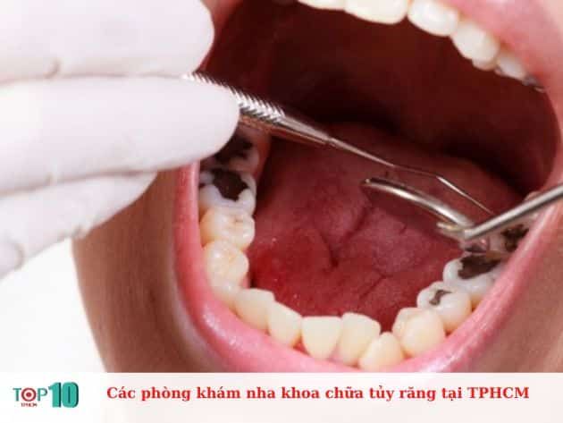 Các phòng khám nha khoa điều trị tủy răng tại TPHCM