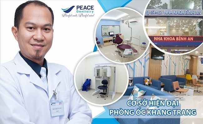 Nha khoa nhổ răng khôn uy tín tại TPHCM - Peace Dentistry