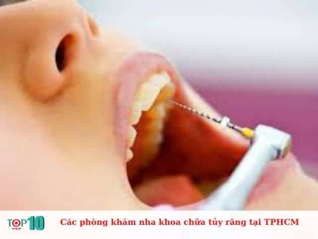 Làm thế nào để lấy tủy răng? Kim Dental chuyên cung cấp dịch vụ lấy tủy răng an toàn và hiệu quả.