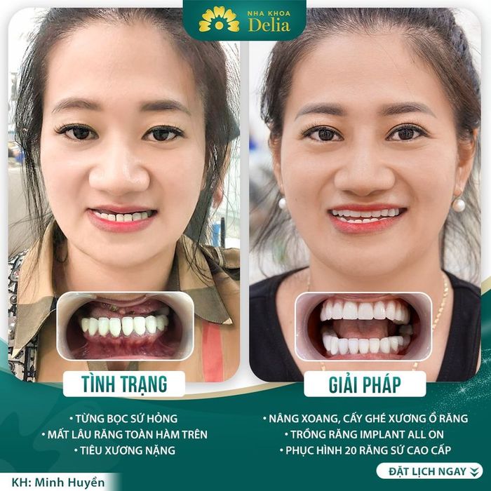 Hình ảnh Nha Khoa Thẩm Mỹ Quốc Tế Delia 2