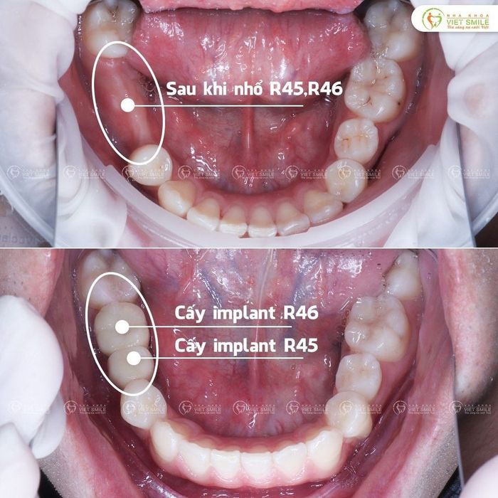 Nha Khoa Thẩm Mỹ VIET SMILE. ảnh 2