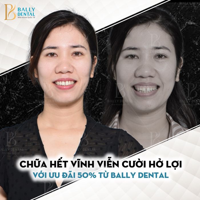 Hình ảnh Nha Khoa Quốc Tế Bally 2