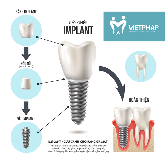 Nha Khoa Quốc Tế Việt Pháp - Hình ảnh 2