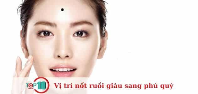 Nốt ruồi trên trán