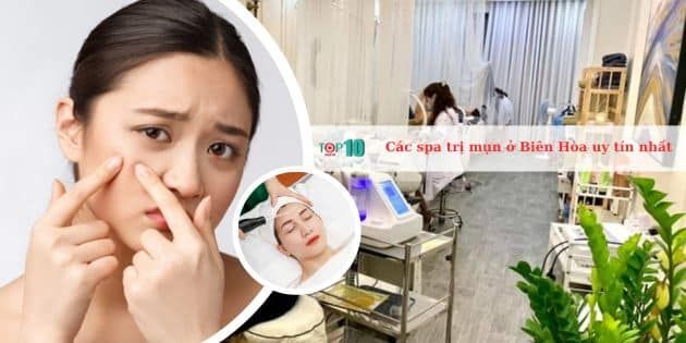 Những Spa Trị Mụn Uy Tín Tại Biên Hòa