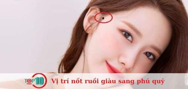 Nốt ruồi trong tóc