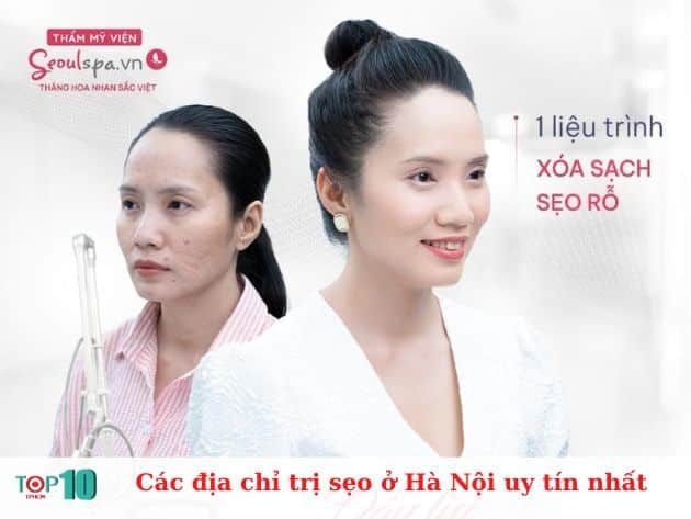 Danh sách các địa chỉ điều trị sẹo uy tín tại Hà Nội