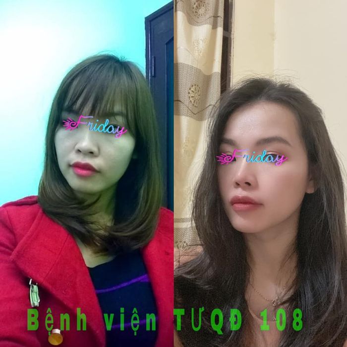 Ảnh 1 tại Bệnh Viện Trung ương Quân Đội 108