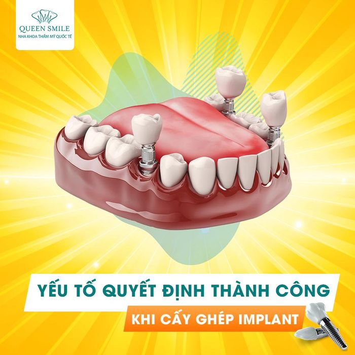 Nha khoa thẩm mỹ Queen Smile ảnh 2