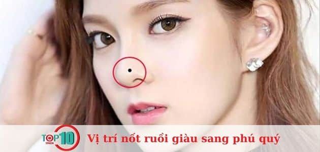 Nốt ruồi trên mũi