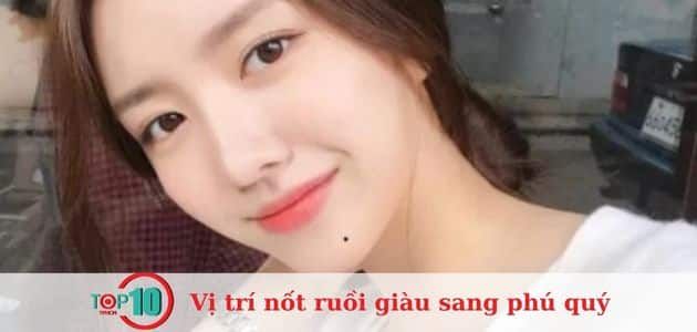 Nốt ruồi ở vùng cằm