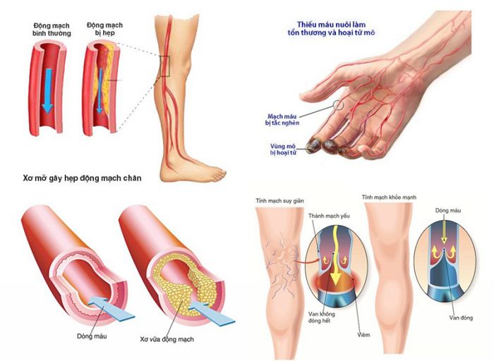 Hình ảnh Bệnh viện Tim Hà Nội 1